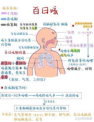 百日咳病儿护理方式