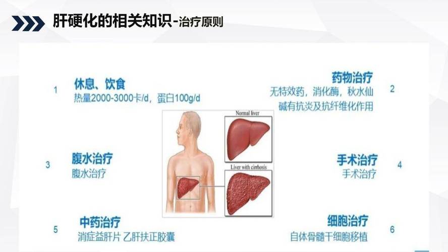 护士肝硬化患者的识别 第2张