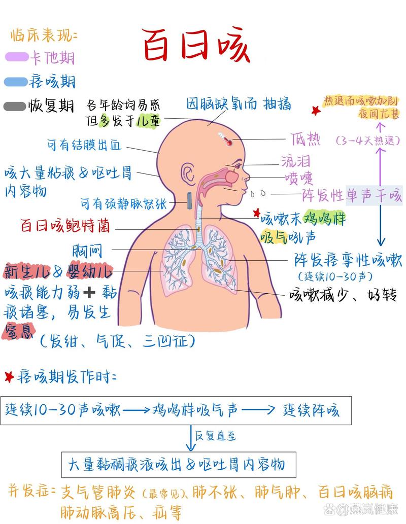 百日咳病儿护理方式 第2张