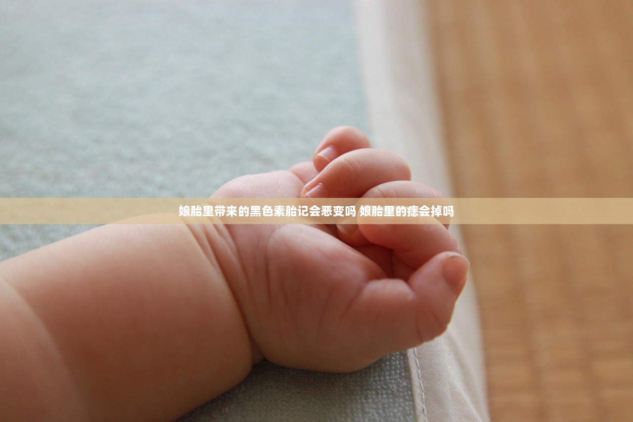 娘胎里带来的黑色素胎记会恶变吗 娘胎里的痣会掉吗